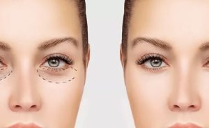 ARC Hair Transplant Clinic