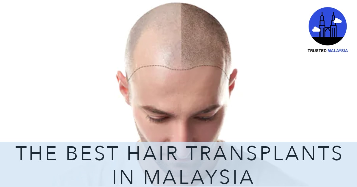 Best Hair Transplants in Malaysia