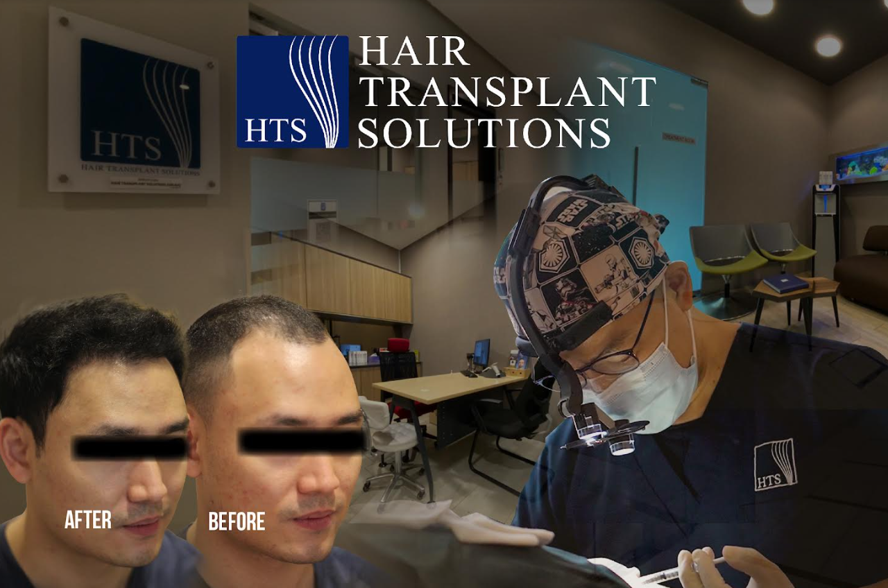 Hair Transplant Solutions 