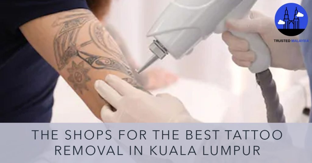 Best Tattoo Removal in Kuala Lumpur