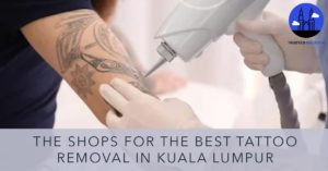 Best Tattoo Removal in Kuala Lumpur