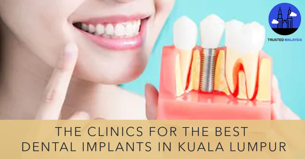 Best Dental Implants in Kuala Lumpur