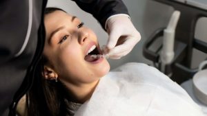 How to Choose the Right Clear Braces