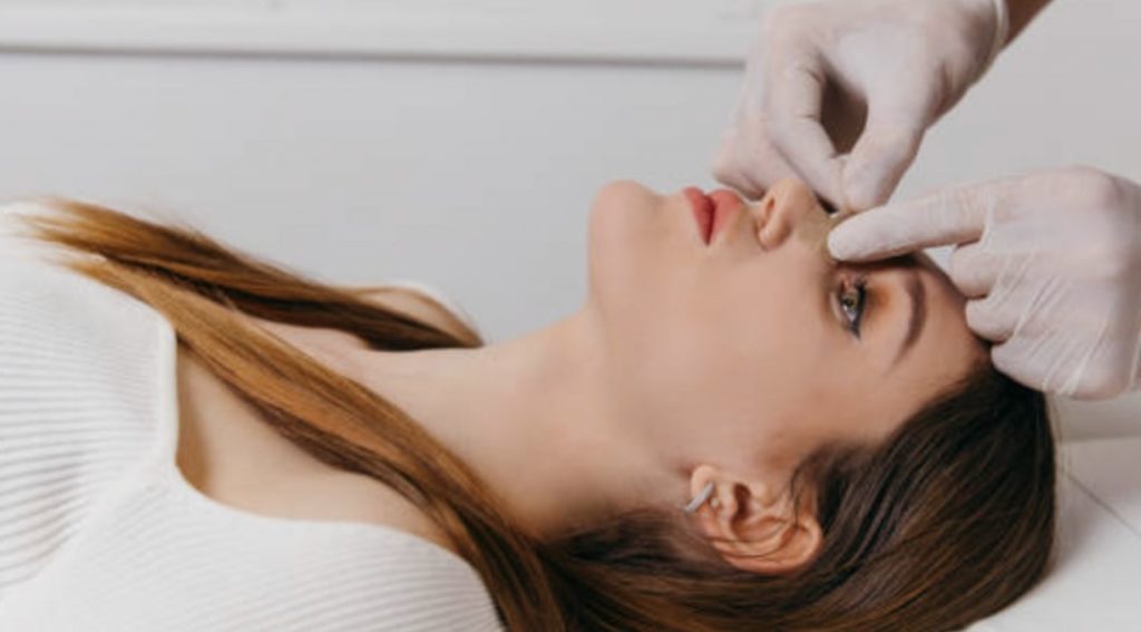 The Procedure of Rhinoplasty